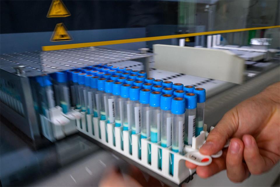 2025 wurden in den Laboren der Landesuntersuchungsanstalt knapp 20.500 Proben von Lebensmitteln untersucht. Bei 15,4 Prozent davon gab es Beanstandungen. Hendrik Schmidt/dpa