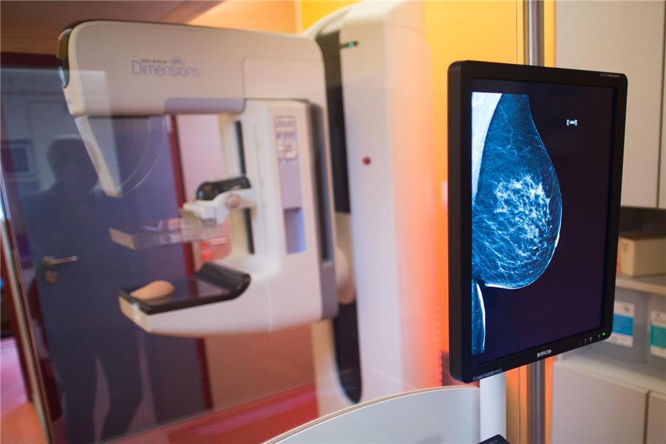 Alle zwei Jahre erhalten Frauen zwischen 50 und 75 eine Einladung zum Mammografie-Screening. (Symbolbild)Klaus-Dietmar Gabbert/dpa-Zentralbild/dpa