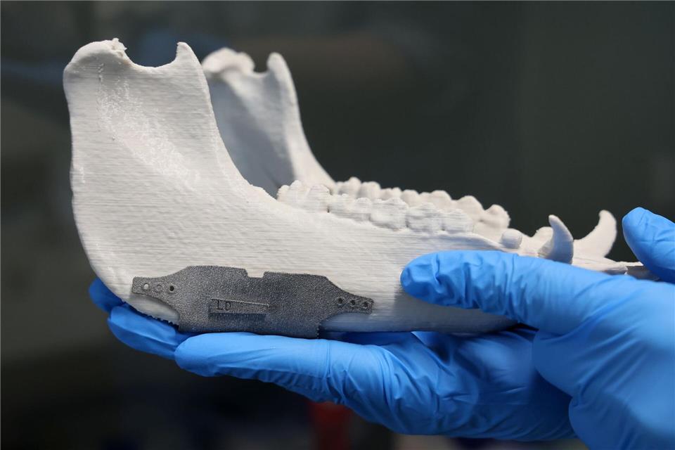 An der Unimedizin Rostock wurde im Rahmen des Forschungsprojektes „Elaine“ ein Test-Implantat aus Titan am Kieferknochen eines Hausschweins hergestellt.Bernd Wüstneck/dpa