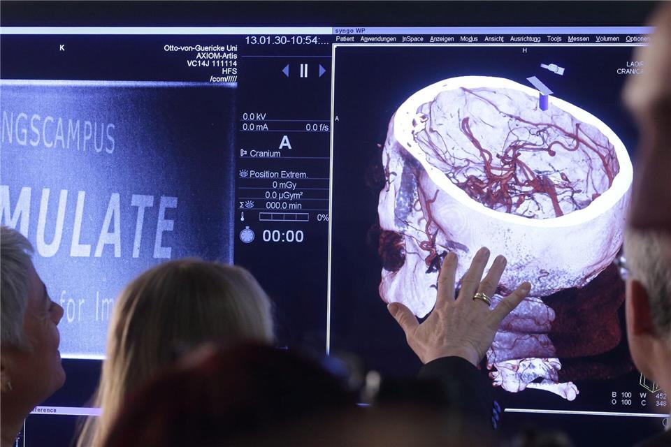 Auch Forschungsprojekte am Medizintechnik-Campus der Universität Magdeburg wurden wieder mit knapp zehn Millionen Euro gefördert. (Archivbild)picture alliance / ZB