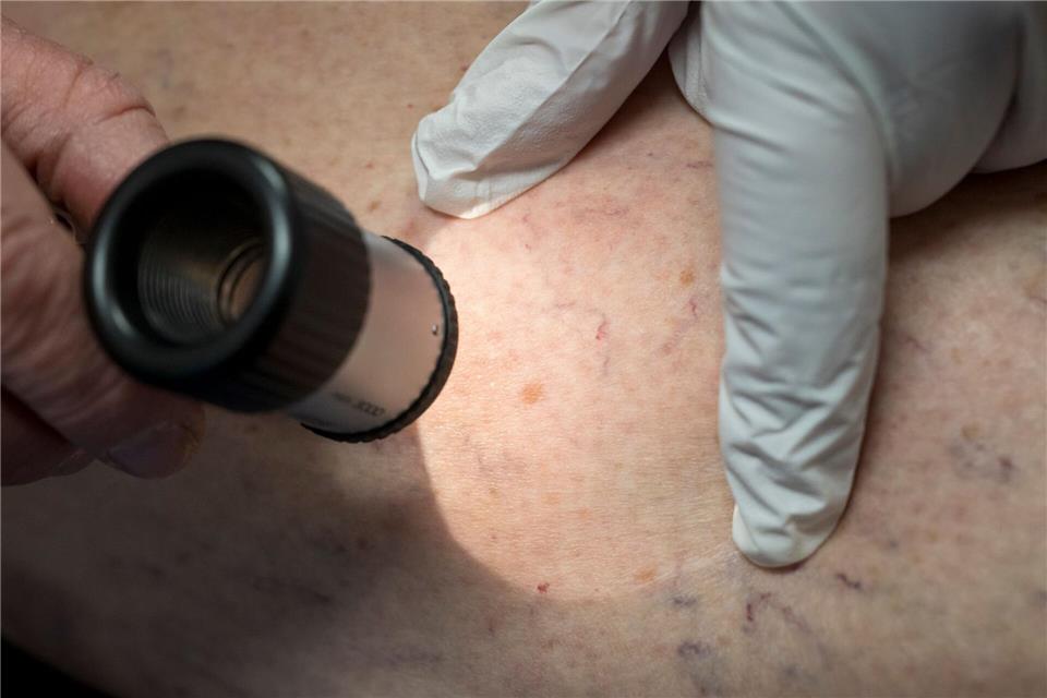 Auffallende Unterschiede gibt es laut AOK-Gesundheitsatlas beim Blick auf die regionale Verteilung. (Archivbild)Peter Kneffel/dpa