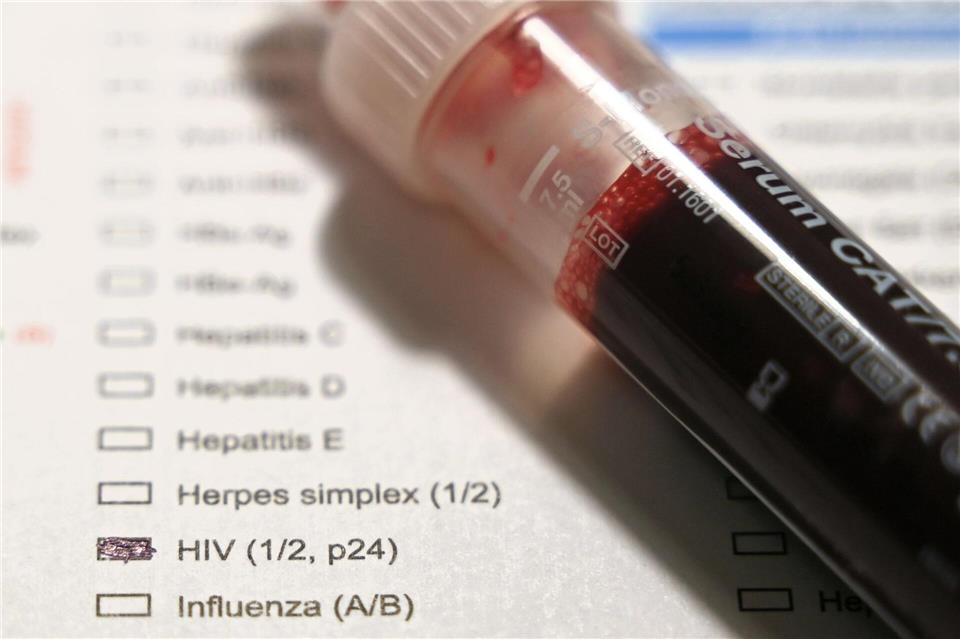 Bei Aids-Hilfen gehört eine Blutprobe zu HIV-Tests. (Archivbild) Elisa Schu/dpa
