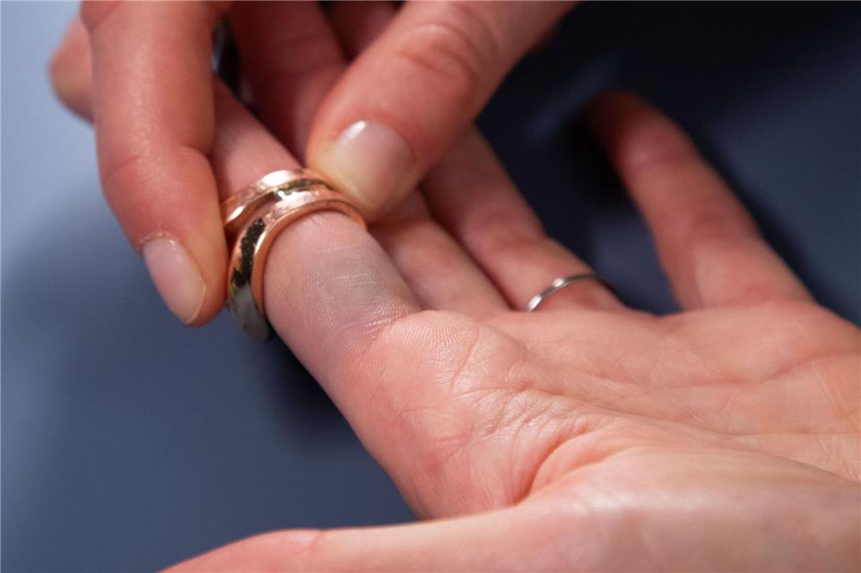 Blaue Ränder durch Modeschmuck? Ein Lifehack soll das verhindern.Christin Klose/dpa-tmn