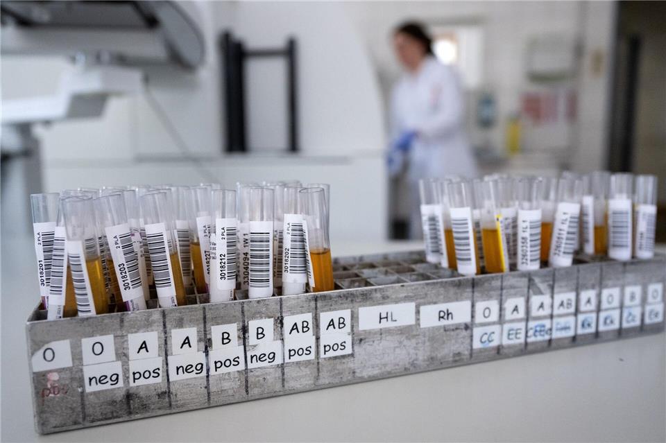 Blut ist nicht gleich Blut: Entscheidend für die Einsortierung in eine Blutgruppe ist, welche Antigene sich auf der Hülle der roten Blutkörperchen befinden.picture alliance/dpa