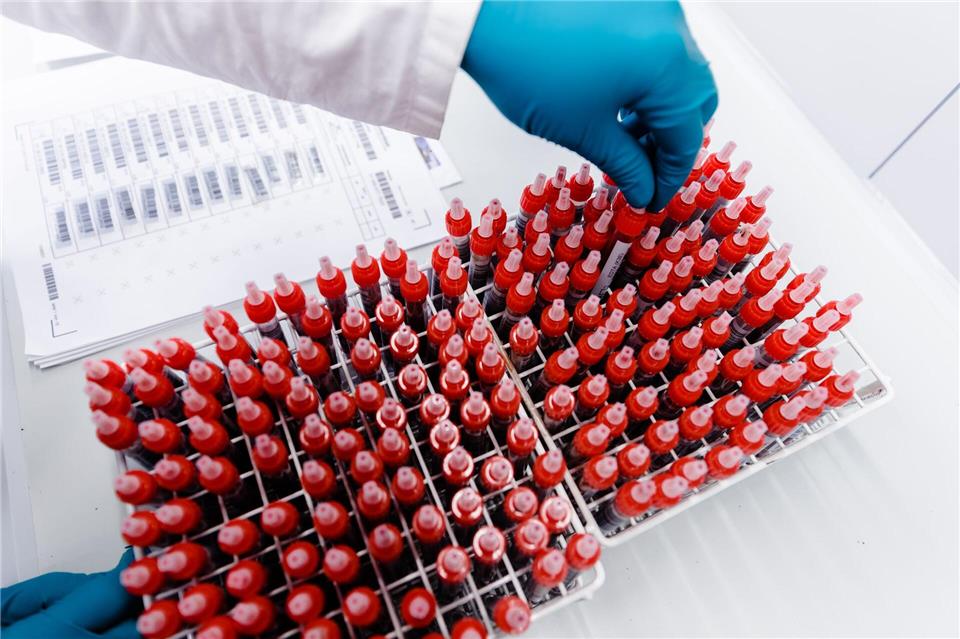 Blut- und Gewebeproben werden in Halle bei extrem niedrigen Temperaturen gelagert. (Symbolbild) picture alliance / Markus Scholz/dpa