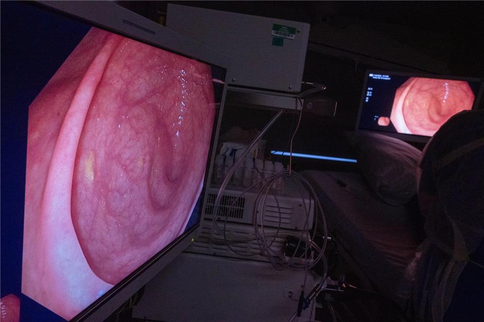 Darmkrebs ist eine Krebsart, die vergleichsweise viele Todesfälle verursacht.Stefan Sauer/dpa