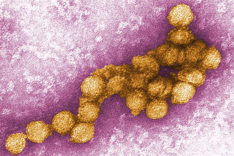 Das West-Nil-Virus unter dem Elektronenmikroskop. (Archivbild)Cynthia Goldsmith/CENTERS FOR DISEASE CONTROL/EPA/dpa