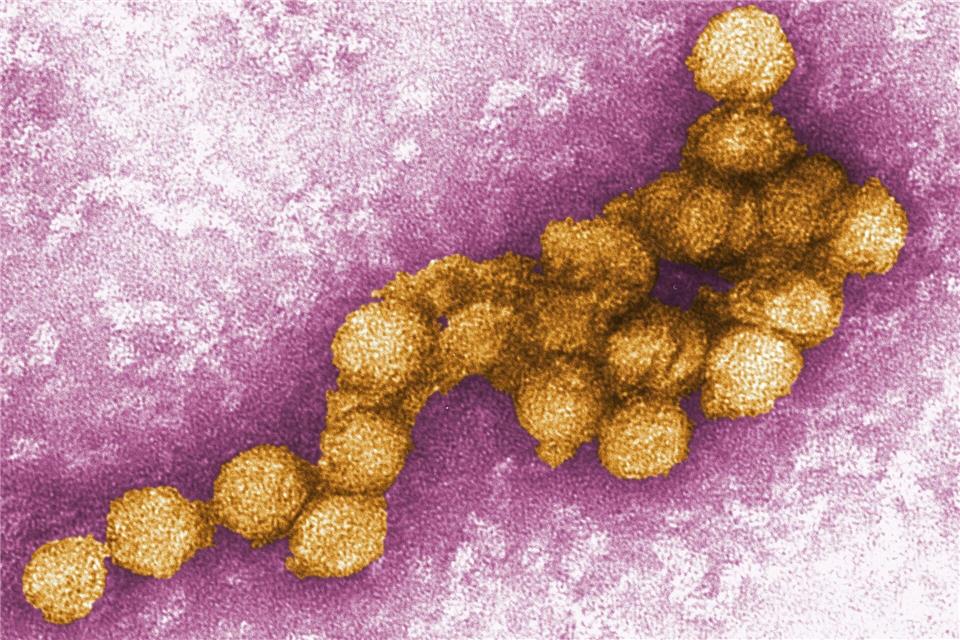 Das West-Nil-Virus unter dem Elektronenmikroskop.Cynthia Goldsmith/CENTERS FOR DISEASE CONTROL/EPA/dpa