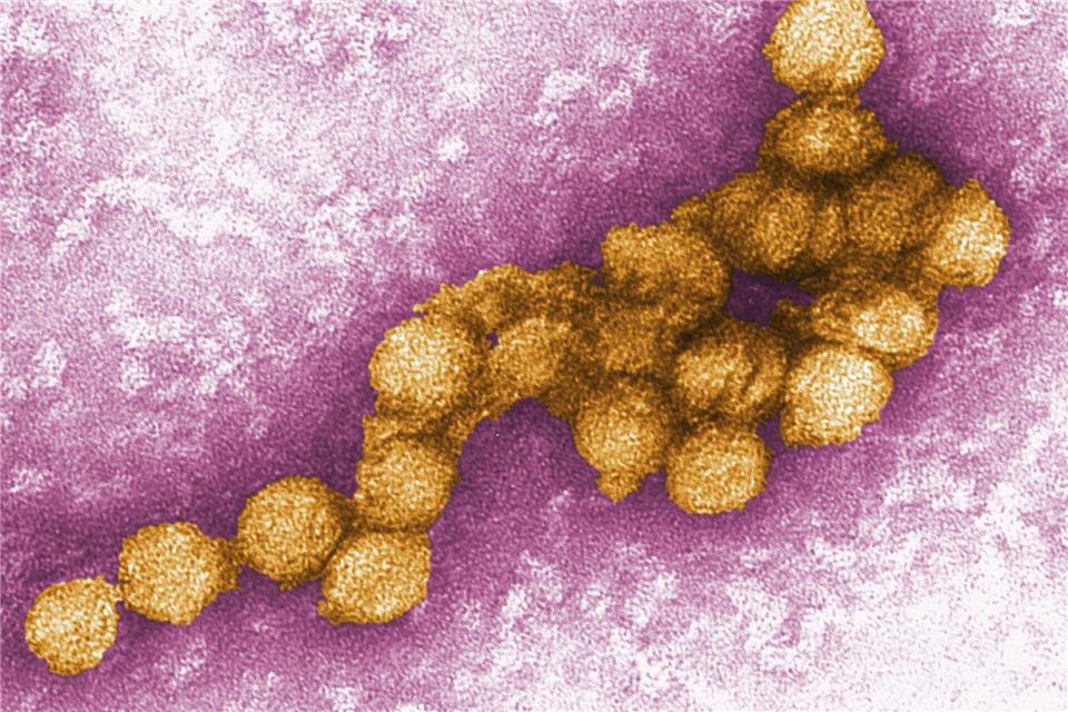Das West-Nil-Virus verbreitet sich auch in Berlin. (Illustration)Cynthia Goldsmith/CENTERS FOR DISEASE CONTROL/EPA/dpa