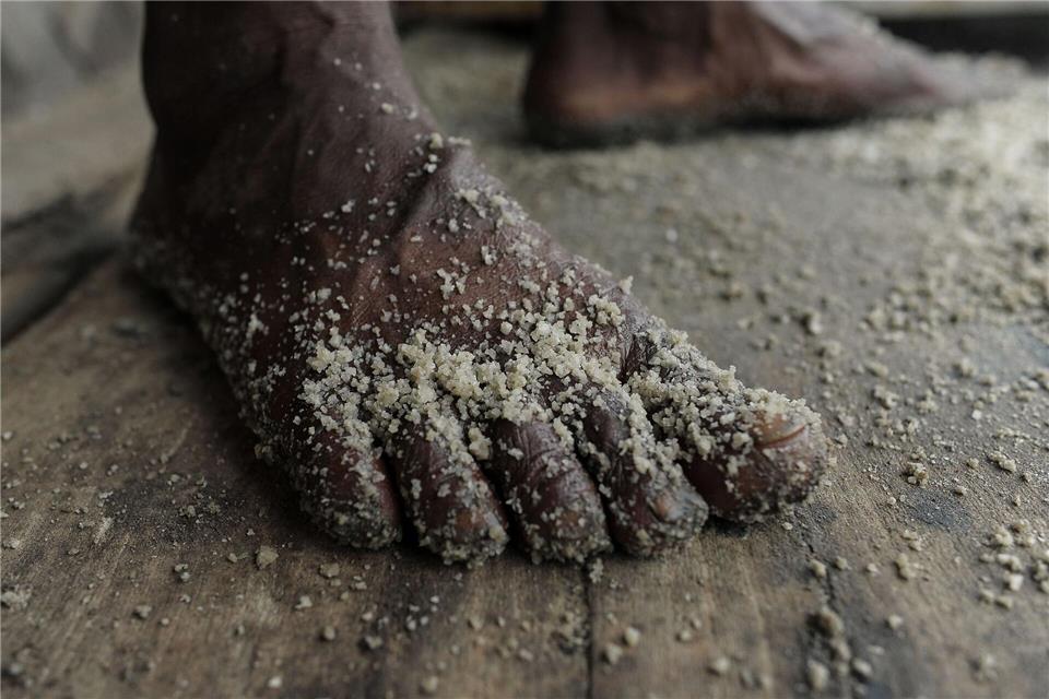 Der Fuß eines Arbeiters ist in einer Rohsalzraffinerie in Bangladesch mit Salz bedeckt.Md Rafayat Haque Khan/eyepix via ZUMA Press Wire/dpa