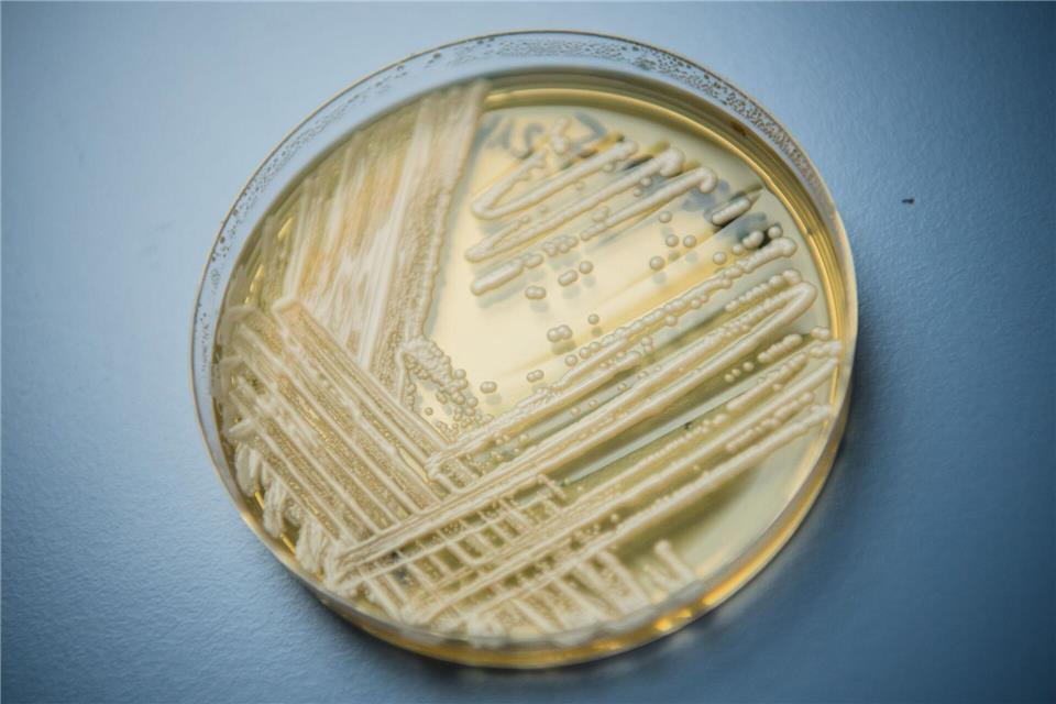 Der Hefepilz Candidozyma auris (früher bekannt als Candida auris).Nicolas Armer/dpa