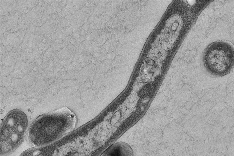 Der Tuberkulose-Erreger (Mycobacterium tuberculosis) unter dem Mikroskop. Robert Koch erhielt für die Entdeckung des Erregers 1905 den Nobelpreis für Medizin. (Symbolbild)picture alliance / dpa