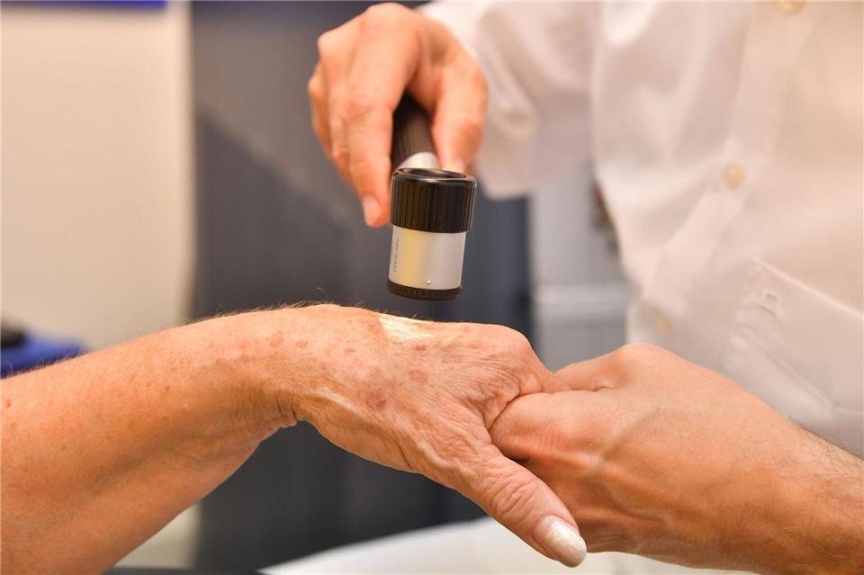 Dermatologische Praxen bieten verschiedene Methoden an, um Altersflecken dauerhaft zu entfernen.Uli Deck/dpa-tmn