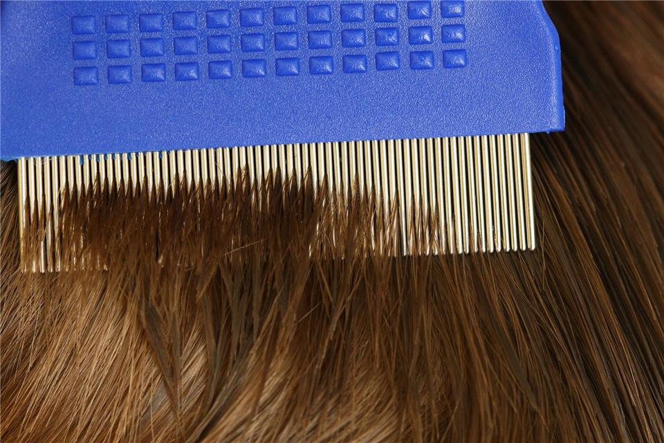 Die AOK registrierte weniger Verordnungen von Mitteln gegen Läusebefall.Patrick Pleul/dpa