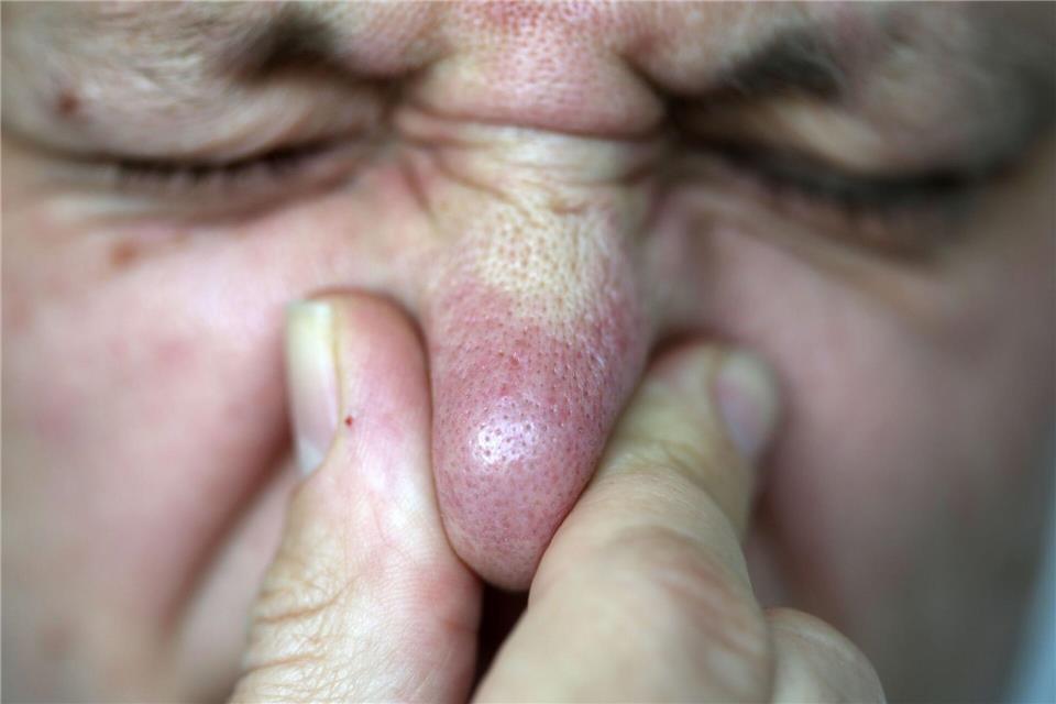 Die Abgasuntersuchung ergab laut dem Landratsamt, dass eine Gesundheitsgefährdung nicht besteht. (Symbolbild)Oliver Berg/dpa