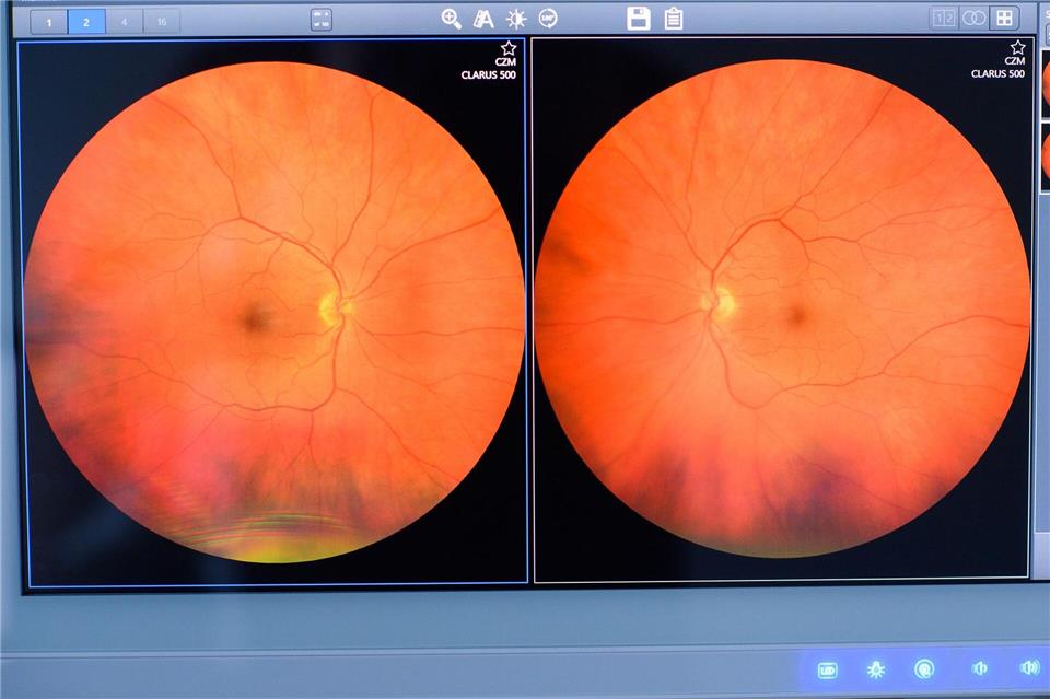Die Daten werden von Augenärzten an anderen Orten ausgewertet.Klaus-Dietmar Gabbert/dpa