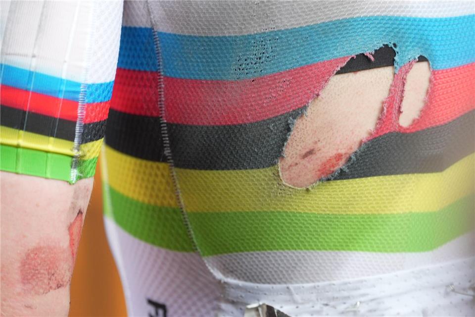 Die Folgen des Sturzes von Tadej Pogacar.Massimi Paolone/LaPresse via AP/dpa