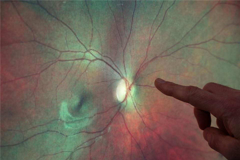 Die feinen Netzhautgefäße können Hinweise etwa auf Herz-Kreislauf- oder auch Nierenprobleme geben.Bernd Wüstneck/dpa