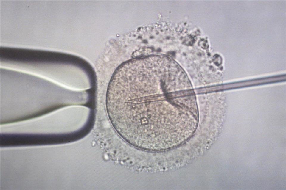 Die künstliche Befruchtung ist eine Möglichkeit für ungewollt kinderlose Paare. (Symbolbild)Focke Strangmann/dpa