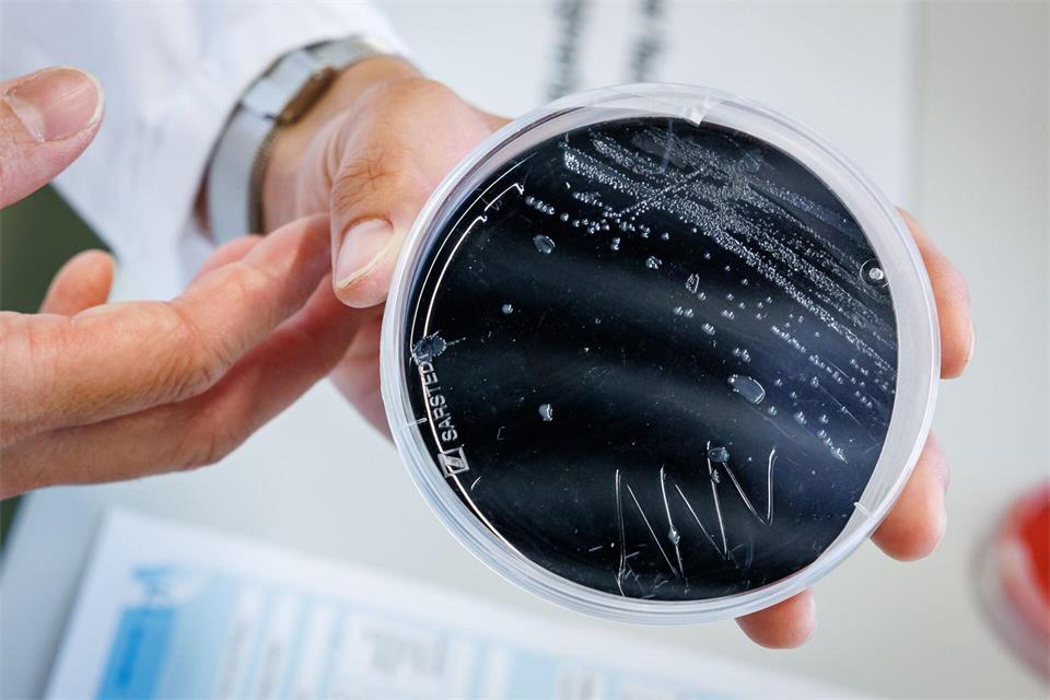 Eine Campylobacter-Kultur im Labor: Der Keim gilt als häufigster bakterieller Durchfall-Erreger. Daniel Karmann/dpa