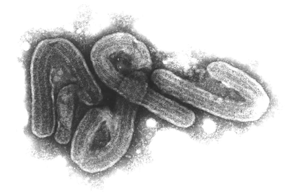 Ruanda erklärt Marburg-Virus-Ausbruch für beendet Eine elektronenmikroskopische Aufnahme des Marburg-Virus. (Archivbild)Bernhard-Nocht-Institut/dpa
