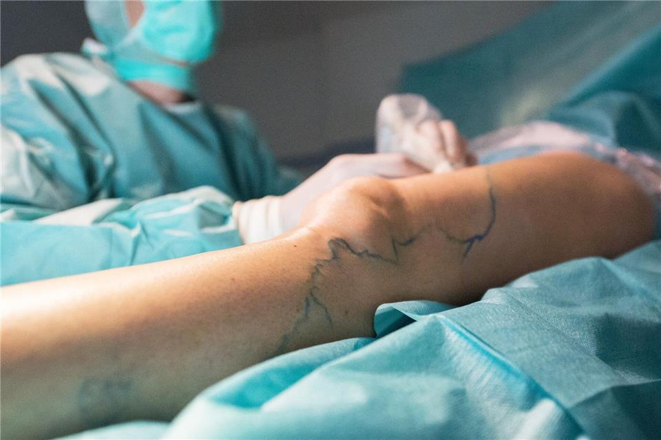 Es gibt verschiedene Möglichkeiten, Krampfadern zu behandeln. Eine Möglichkeit ist, sie mit Hilfe eines Lasers als Hitzequelle zu verschließen.picture alliance/dpa/dpa-tmn