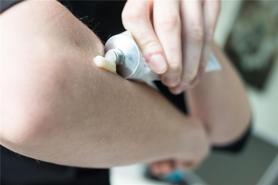 Fünf Schmerzsalben schneiden bei der Zeitschrift „Öko-Test“ sehr gut ab - drei setzen auf Ibuprofen, jeweils eine auf Piroxicam und Felbinac. picture alliance/dpa