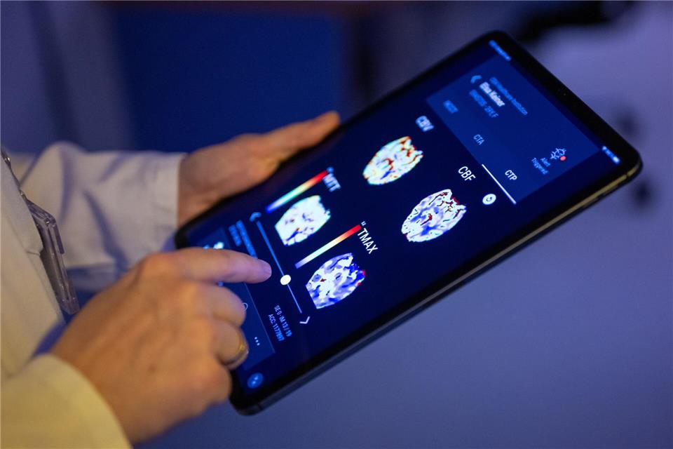Gehirnbilder eines Patienten in einer KI-basierten App. Nach einer Deloitte-Umfrage sehen viele Bürgerinnen und Bürger den Einsatz von KI in der Medizin skeptisch, vor allem wenn es um die Therapie geht. (Symbolbild)Monika Skolimowska/dpa