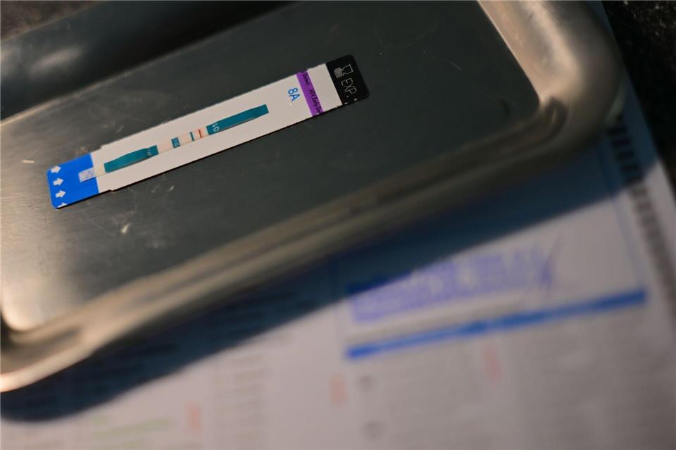 HIV-Diagnosen werden oft erst Jahre nach der Infektion gestellt. (Symbolbild)Sebastian Gollnow/dpa