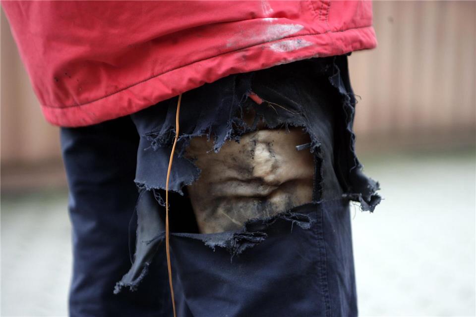 Hohe Verletzungsgefahr, sollten sie zünden: Böller und Co. gehören nicht in Hosen oder Jackentaschen. Daniel Bockwoldt/dpa/dpa-tmn