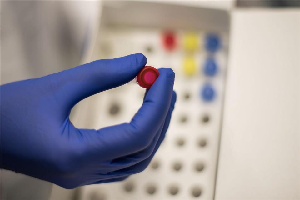 In Mainz sei in den vergangenen Jahren sehr viel für die Biotechnologie-Branche angeschoben worden, sagt der Verband Bio Deutschland. (Symbolbild)Andreas Arnold/dpa