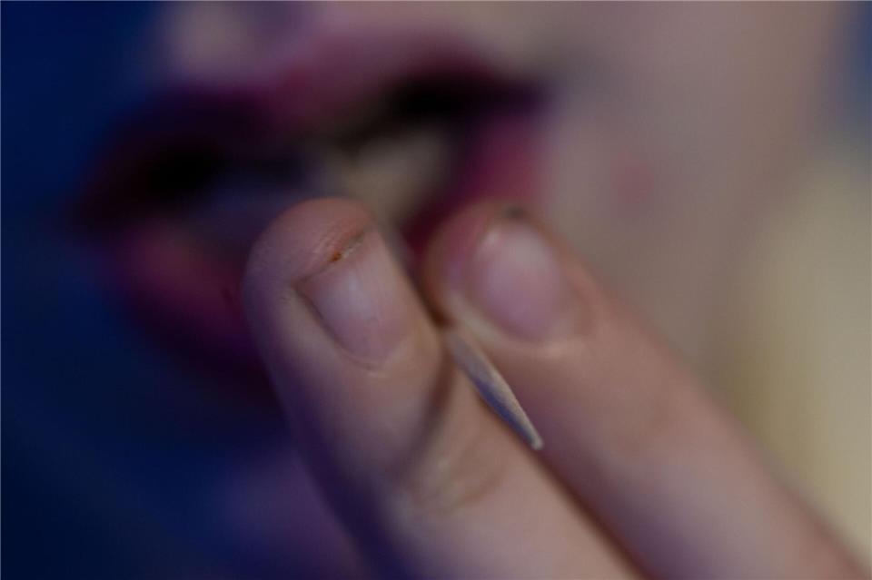 In München hat eine Schule Zahnstocher verboten - aus Gründen. (Symbolbild)Pia Bayer/dpa