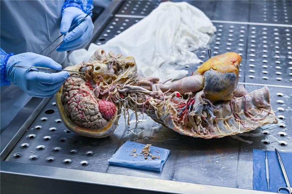 In der Werkstatt im brandenburgischen Guben entstehen die Plastinate der Organe. (Archivbild)Patrick Pleul/dpa