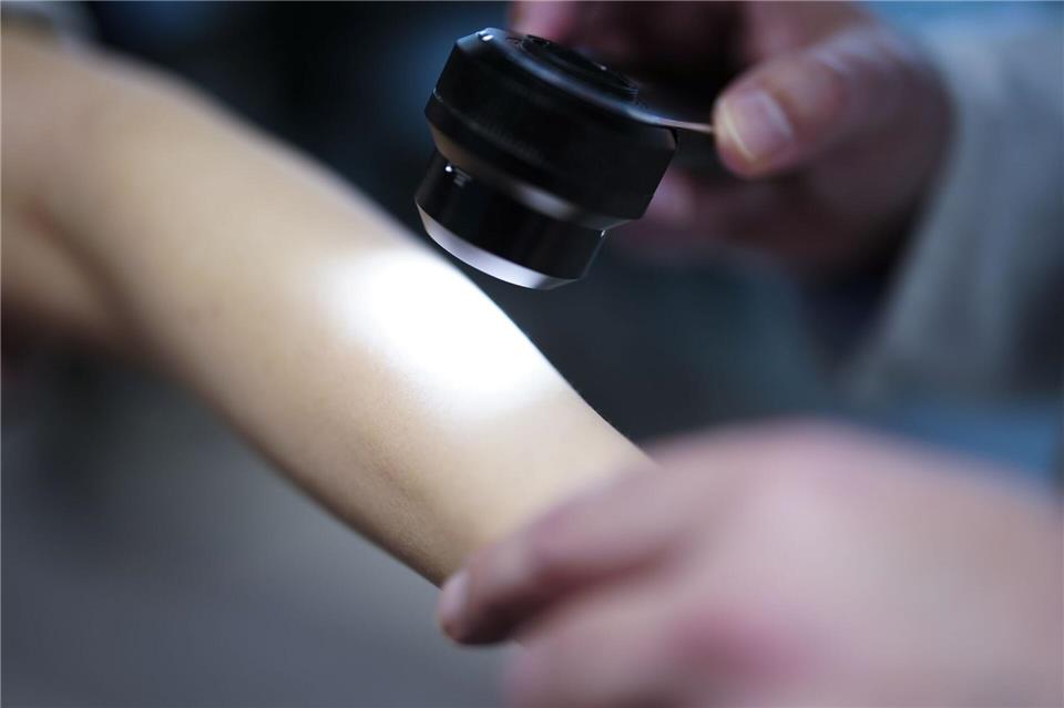 In vielen Regionen Sachsens ist die dermatologische Versorgung in den vergangenen Jahren deutlich zurückgegangen (Symbolbild)Eva Manhart/APA/dpa