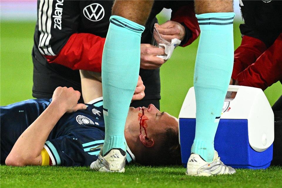 Joshua Kimmich liegt verletzt am Boden. Er konnte aber weiterspielen.Tom Weller/dpa