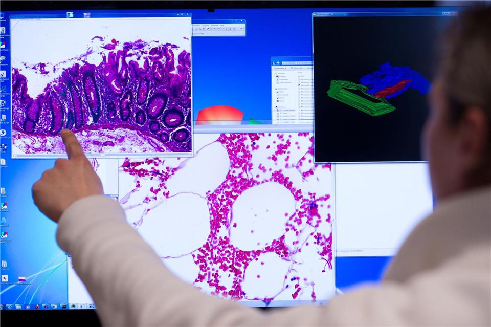 Krebs bleibt eine der häufigsten Todesursachen bei Frauen und Männern im Saarland. (Symbolbild)Bernd von Jutrczenka/dpa