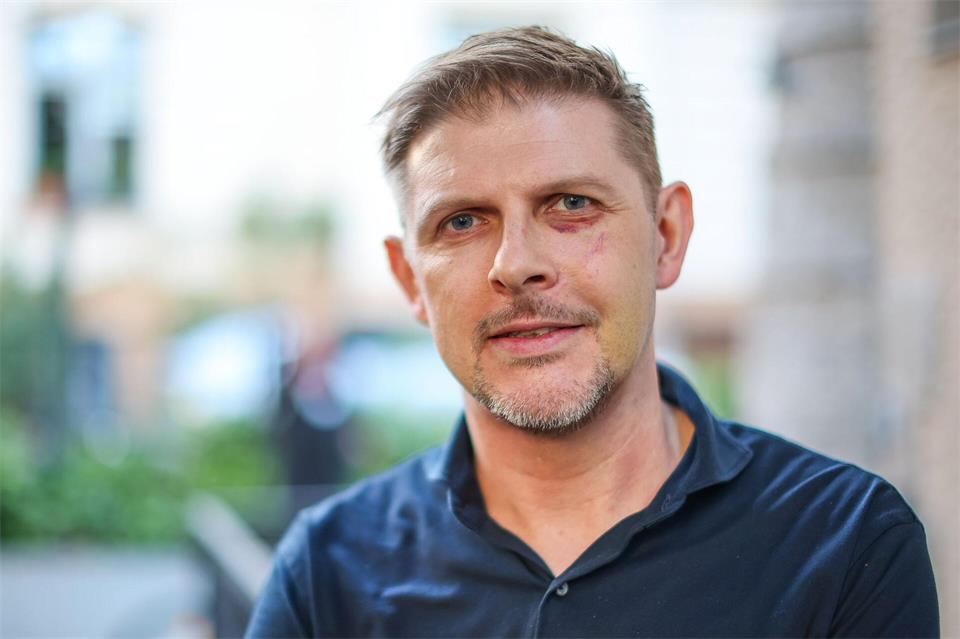 Matthias Ecke (SPD) wurde am 3. Mai 2024 beim Aufhängen von Wahlplakaten angegriffen. (Archivbild)Jan Woitas/dpa