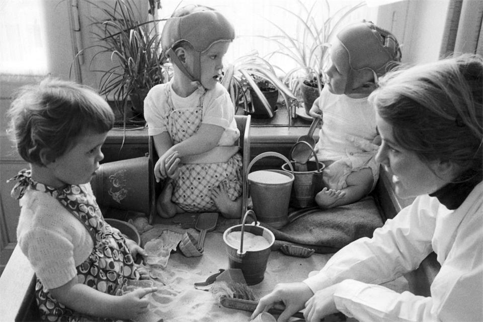 Missbildungen waren die Folge von Contergan-Einnahme während der Schwangerschaft. (Archiv)picture alliance / dpa