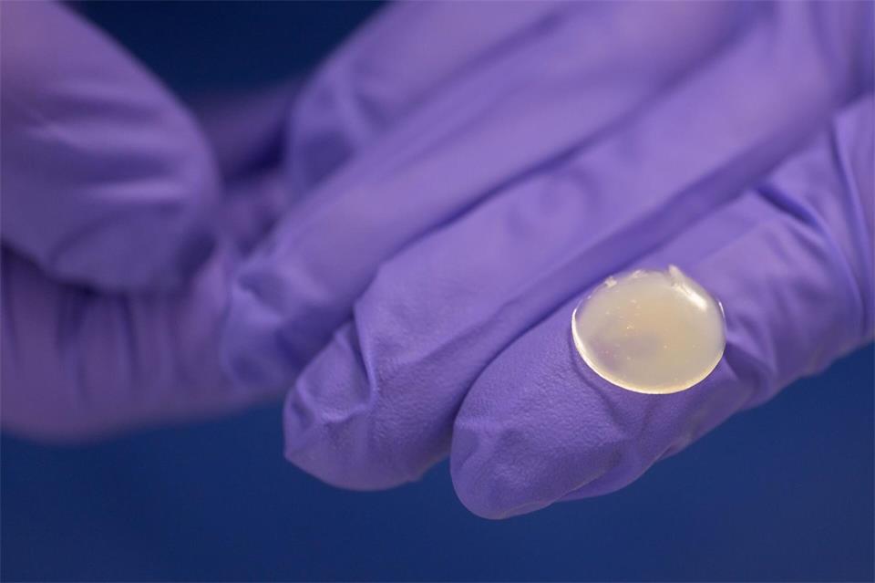 Mit dem 3D-Arzneimitteldrucker können Dosis, Konsistenz, Form, Größe und Geschmack auf die Bedürfnisse der Patienten und Patientinnen angepasst werden.Izabela Mittwollen/dpa