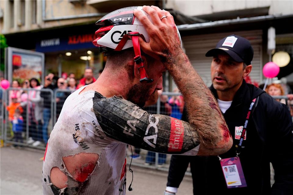 Mitfavorit Adam Yates stürzte beim Giro d’Italia schwer.Fabio Ferrari/LaPresse/AP/dpa