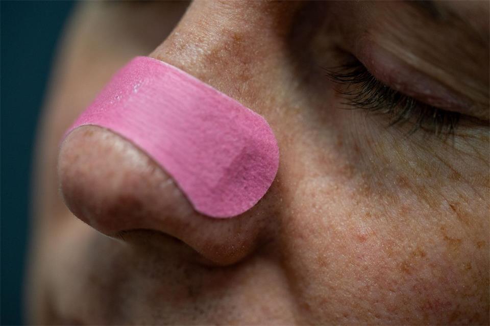 Nasenpflaster werden quer über den Nasenrücken geklebt und können die Nasenflügel sanft anheben, um die Atmung zu erleichtern.Zacharie Scheurer/dpa-tmn