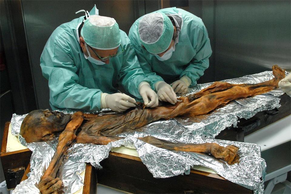 Ötzi wurde hundertfach untersuchtM.Samadelli/Southtyrolarchaeologymuseum\Eurac via Eurekalert/dpa