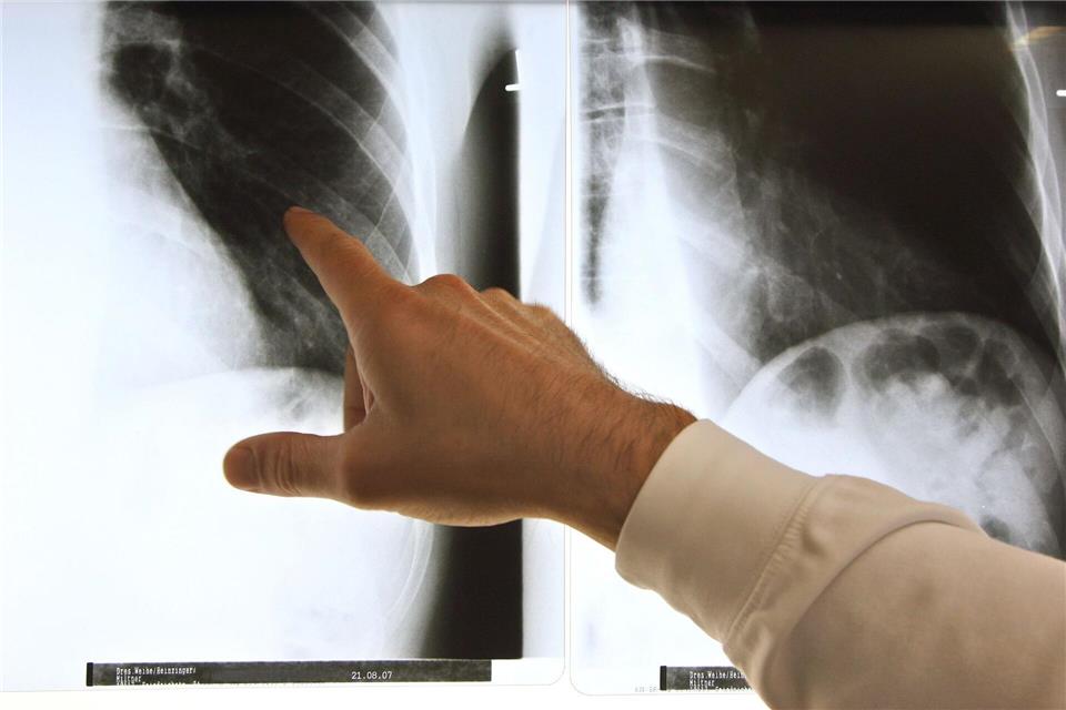 Patientenschützer sind über die geplanten Neuregelungen bei der Ärztewahl besorgt. (Archivbild)Arno Burgi/dpa-Zentralbild/dpa