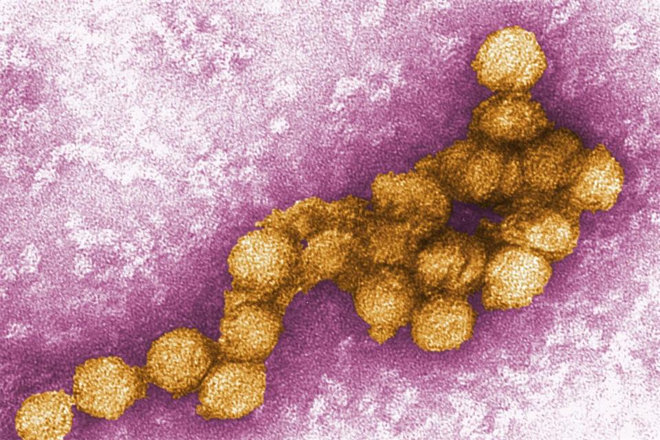 So sieht das West-Nil-Virus unter dem Elektronenmikroskop aus. (Archivbild)Cynthia Goldsmith/CENTERS FOR DISEASE CONTROL/EPA/dpa