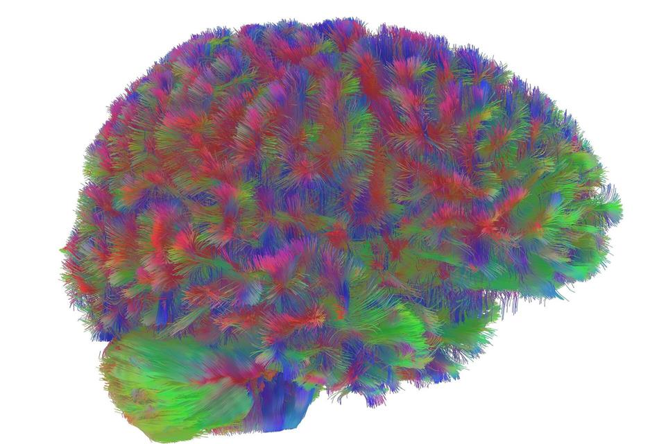 Sogenannte MRT-Diffusionsscans lassen deutliche Unterschiede der Hirnstruktur abhängig vom Alter erkennen.Dr Alexa Mousley/University of Cambridge/dpa