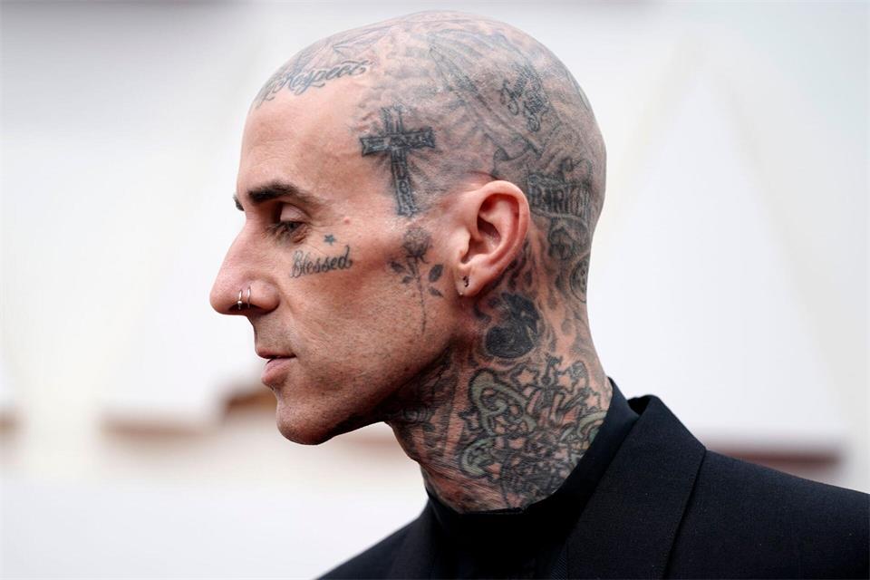 Travis Barker geht davon aus, dass er in ein paar Wochen wieder fit ist. (Archivbild)Jae C. Hong/Invision/AP/dpa