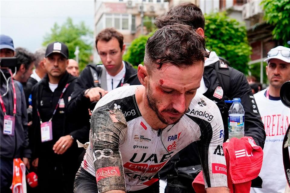 Trotz seines schweren Sturzes fuhr Adam Yates zunächst weiter.Fabio Ferrari/LaPresse/AP/dpa