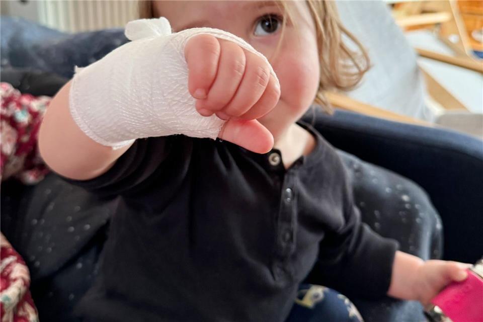 Verbrannt am heißen Pfannenrand: Ein Wundverband schützt die verletzte Stelle.Till Simon Nagel/dpa-tmn