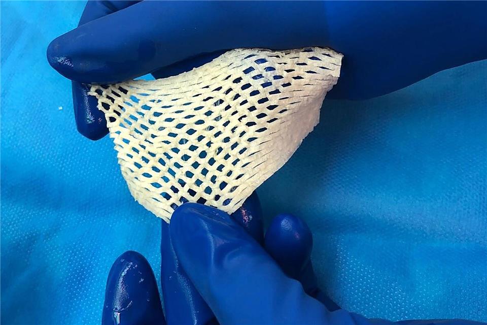 Wichtige Alternative für Hautttansplantationen: Fischhaut.Saziye Karaca/-/dpa