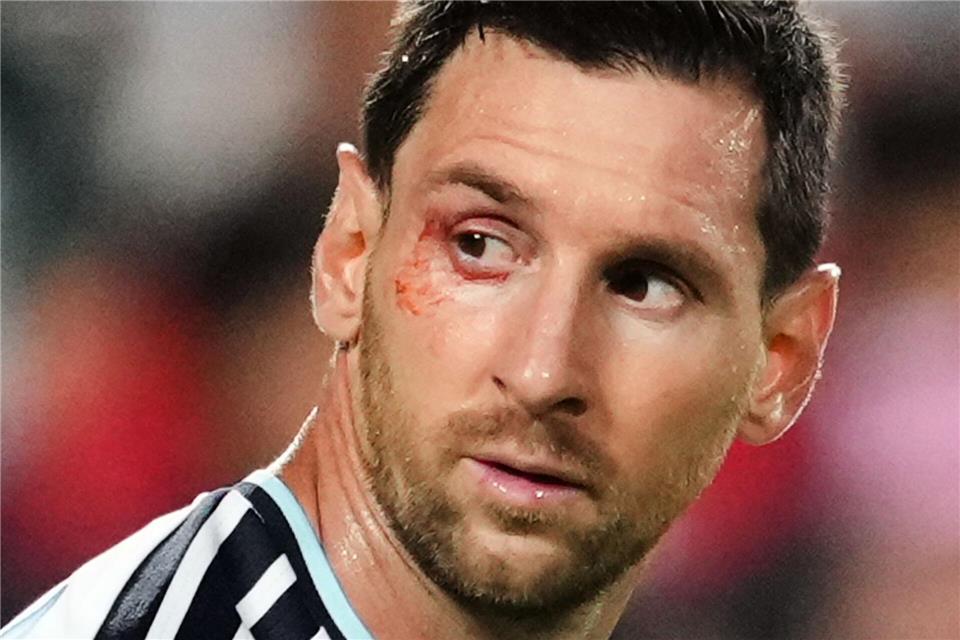 Wieder gezeichnet: Superstar Lionel Messi. Ed Zurga/AP/dpa